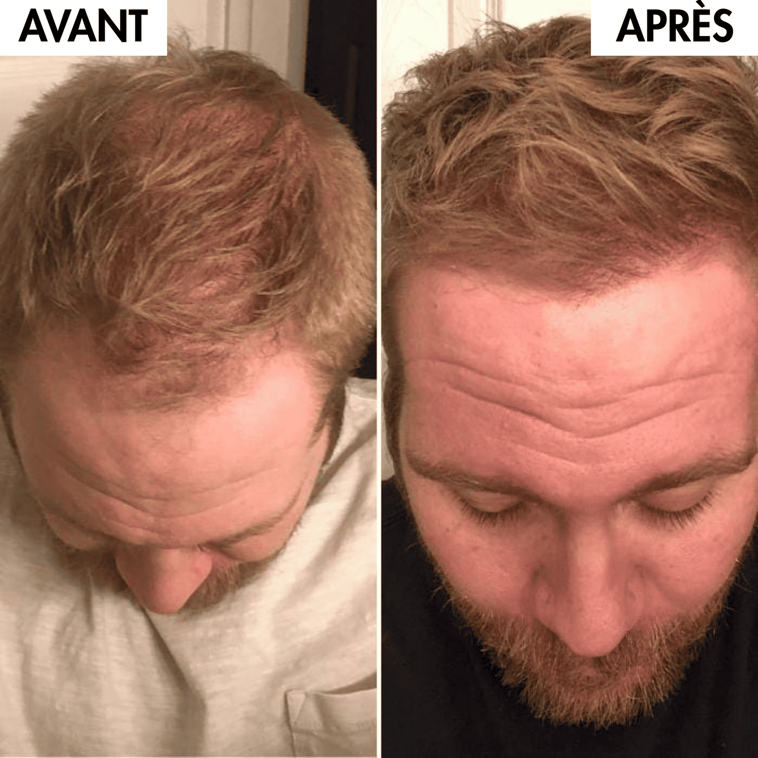 Pack Boost & Force™ - Croissance & Hydratation MY BEAUTY ROUTINE