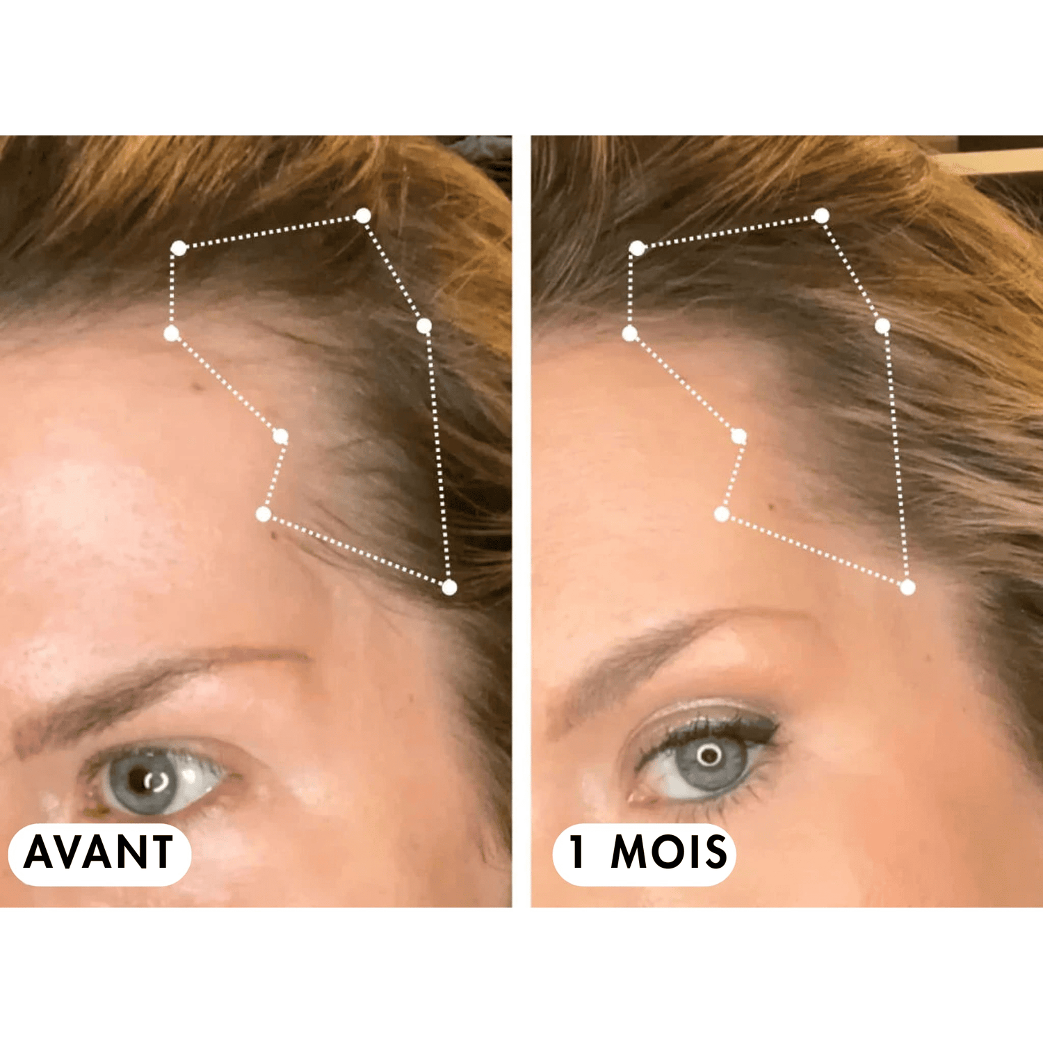 Pack Boost & Force™ - Croissance & Hydratation MY BEAUTY ROUTINE