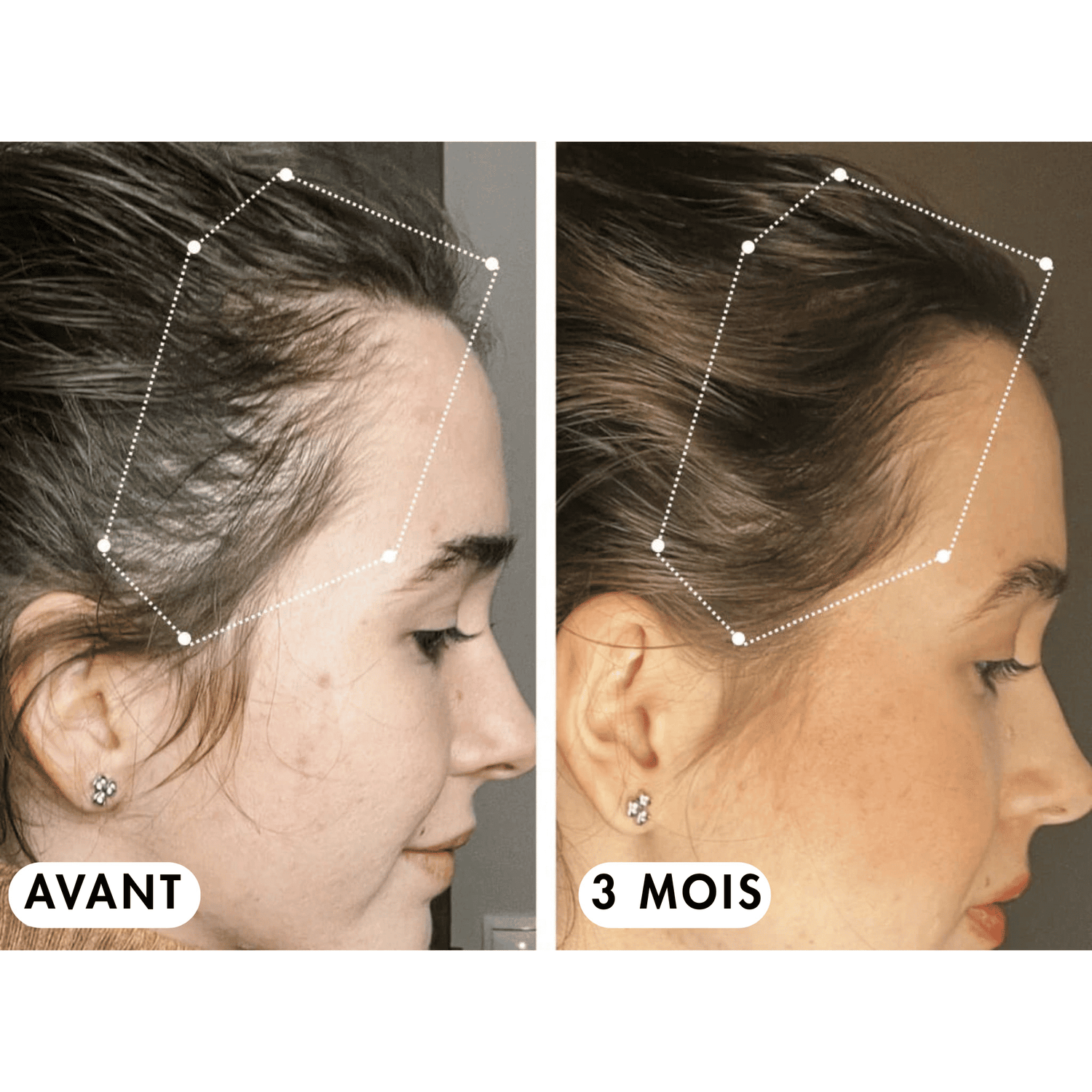 Pack Boost & Force™ - Croissance & Hydratation MY BEAUTY ROUTINE