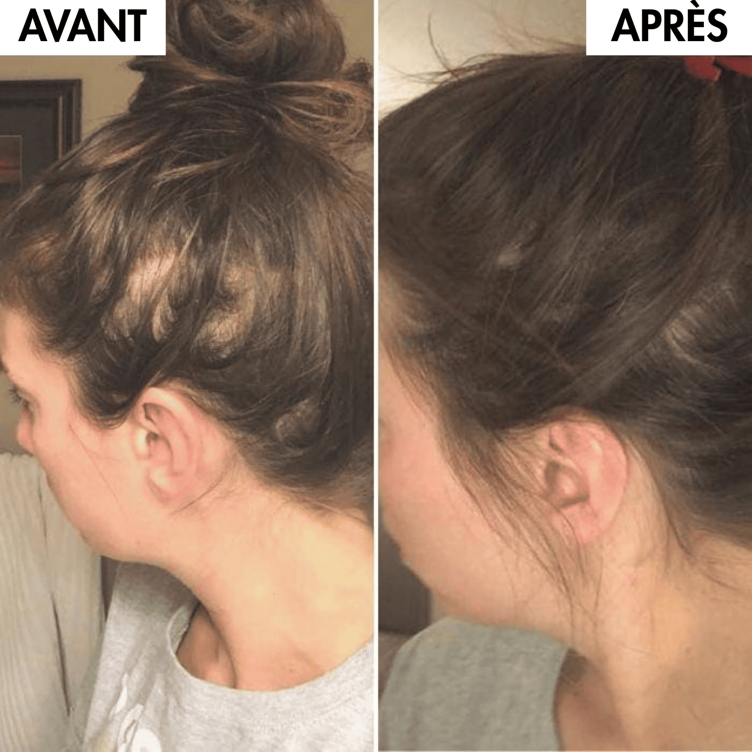 BOOST & GLOW - Lotion Anti-chute & Croissance 200ml MY BEAUTY ROUTINE