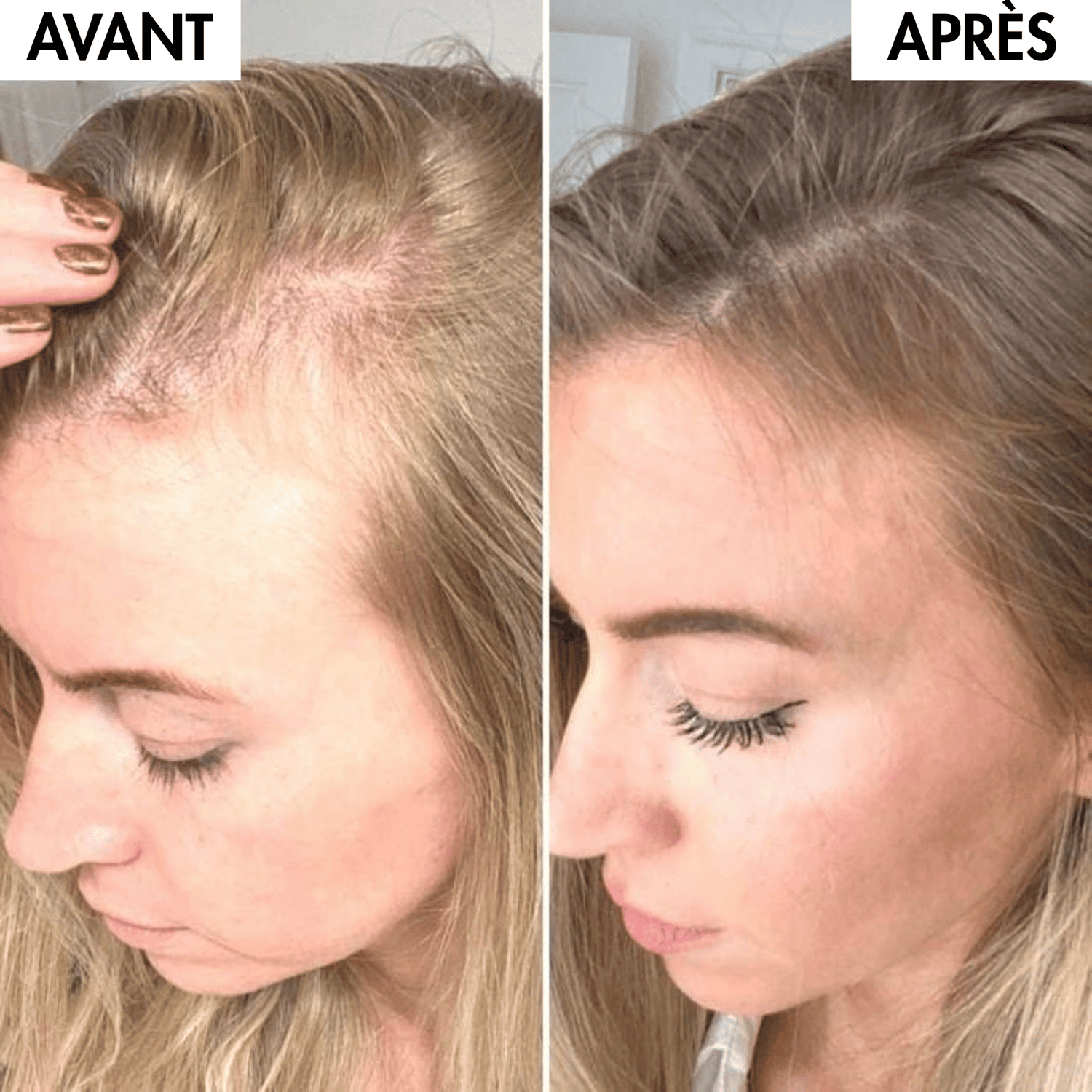 Pack Boost & Force™ - Croissance & Hydratation MY BEAUTY ROUTINE